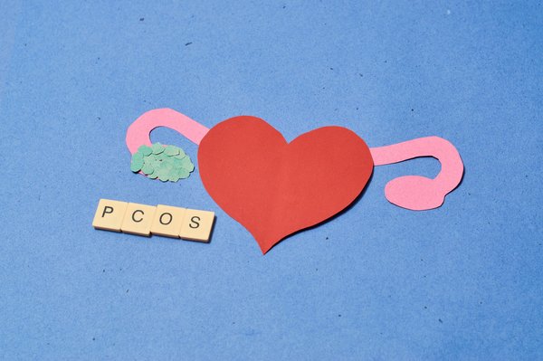 How Can Lifestyle Modifications Aid in Managing Polycystic Ovary Syndrome (PCOS)?